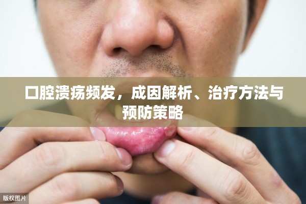 口腔溃疡频发，成因解析、治疗方法与预防策略